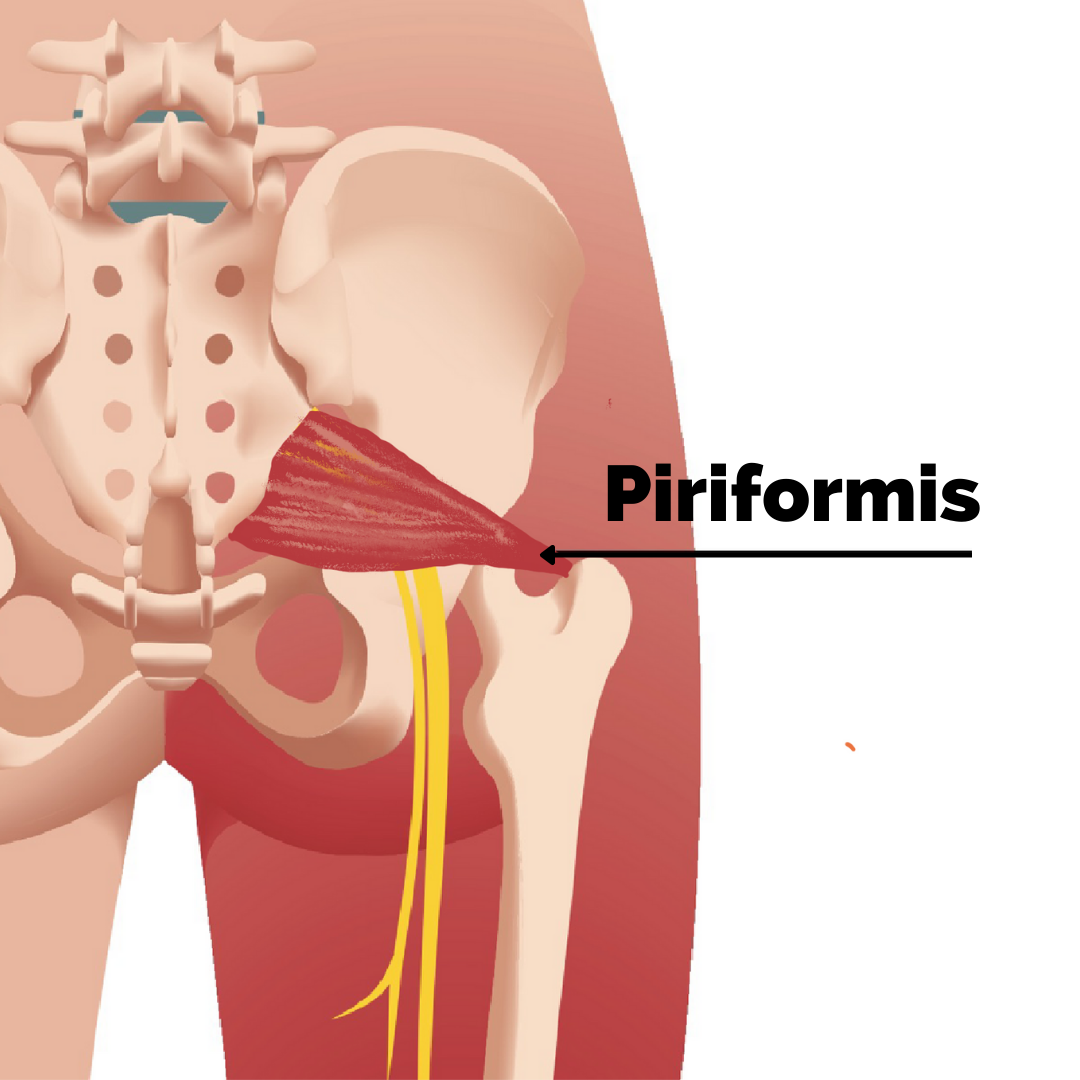 Sciatic Pain Fitstreams Club